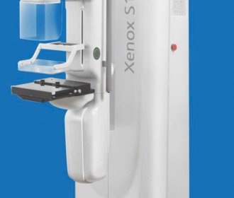 MÁY CHỤP NHŨ ẢNH MAMMOGRAPHY S100