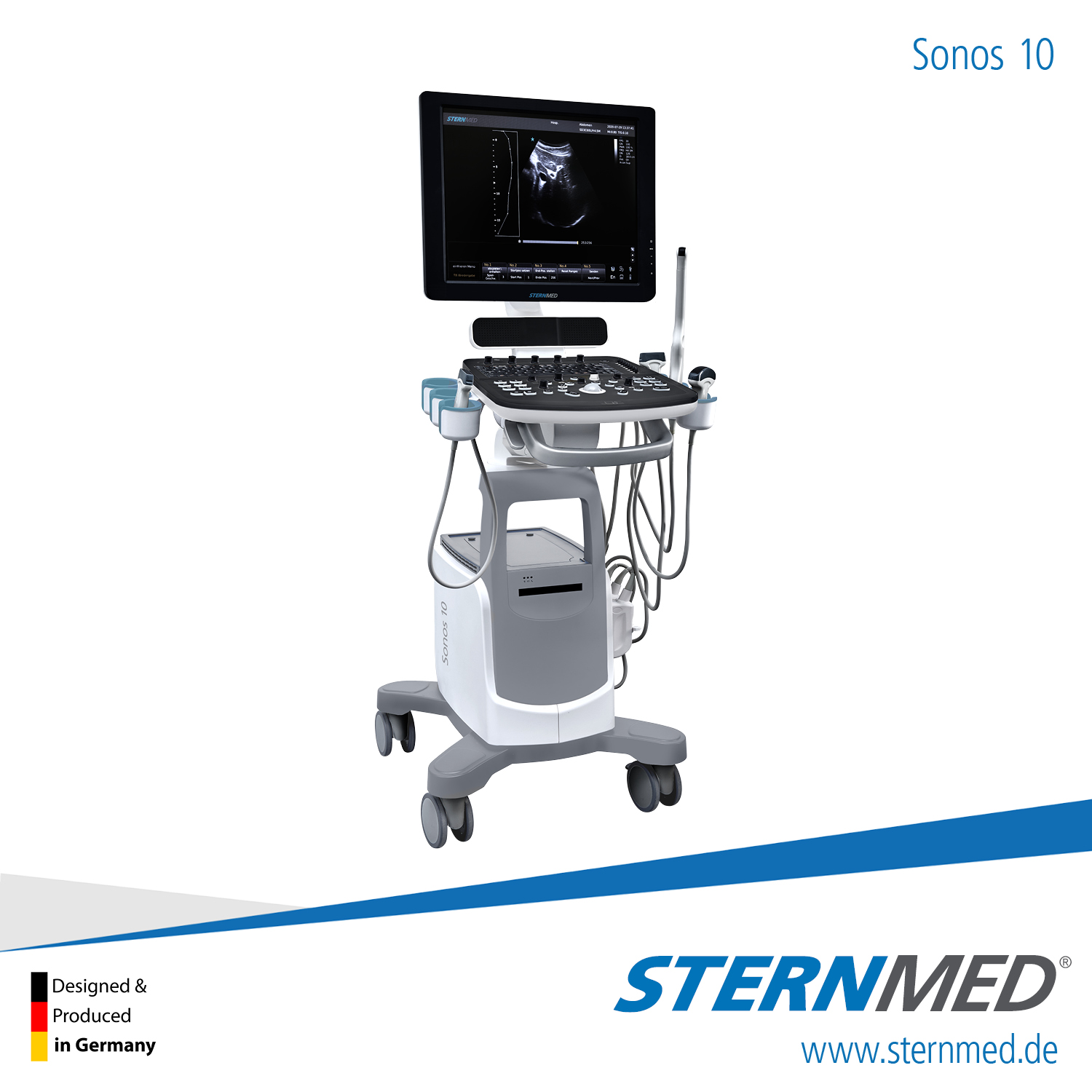 SIÊU ÂM MÀU SONOS 10